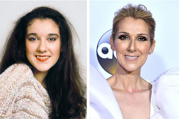 Селин Дион до и после того как сделала зубы фото 