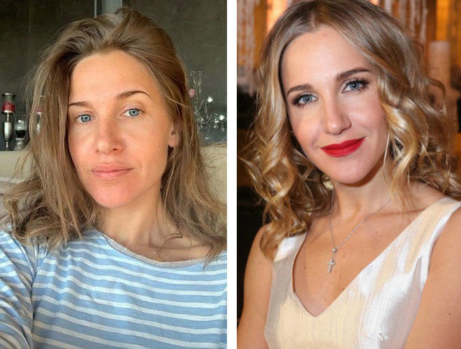 Юлия ковальчук до и после пластики фото
