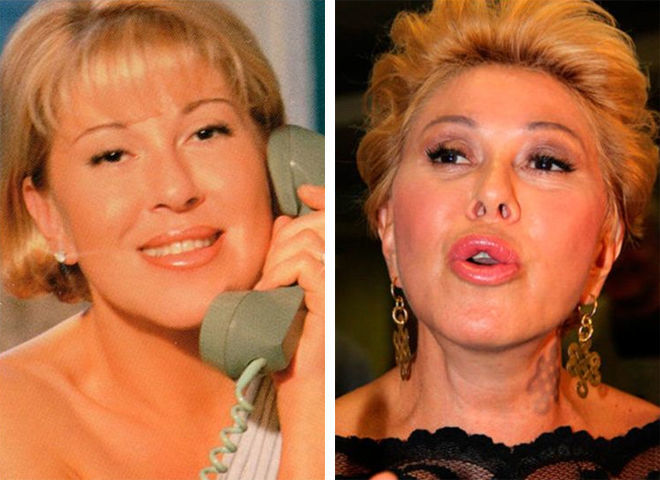 Знаменитости, которые увеличили губы и стали выглядеть ужасно: фото До и После